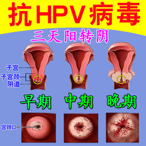 150ml*1瓶/盒 霉菌性阴道炎非特异性阴道炎 外阴瘙痒 红核妇科洗液