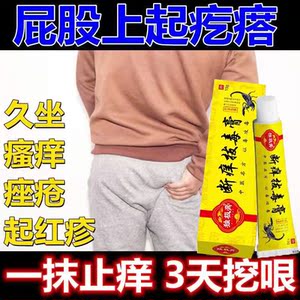 消痤膏玫芦屁股疮屁股上有疙瘩久坐长痘痘屁股疹湿痒长痱子屁股疼