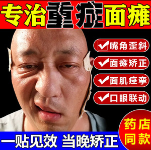 【包去除】冶疗面瘫贴牵正膏嘴歪眼斜面瘫后遗症面部抽搐麻木痉挛