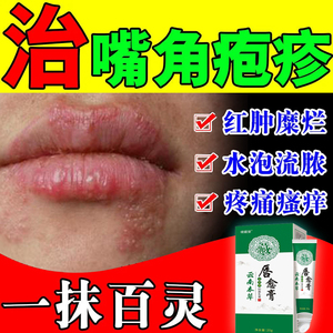 嘴角疱疹治嘴唇嘴巴唇炎上火起小水泡干裂红肿糜烂修复乳膏一抹灵
