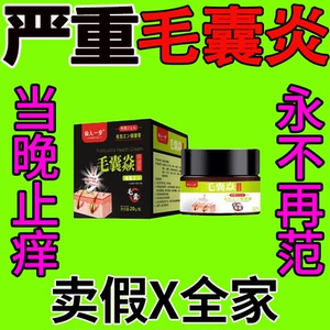 毛囊炎专用药头部药头皮膏头痒前胸有疙瘩头上长痘痘皮脂溢性炎