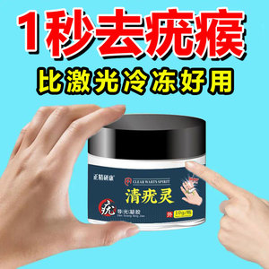 去疣药膏扁平疣一抹灵正品去除膏面部专用清疣膏肉刺瘊子丝状神器