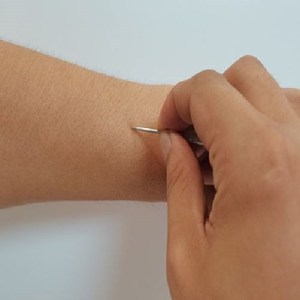 挑针挑治针经络环皮部挑治针挑针经络环皮部挑针垂成教育【108日e