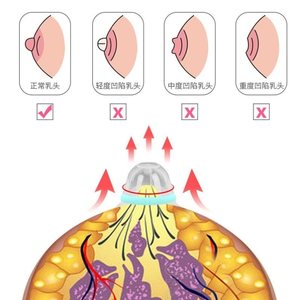 乳头内陷矫正器吸乳头少女凹陷牵引器孕妇隐形拔奶头短小固定夹.