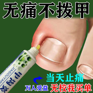 消肿止痛甲勾炎药膏发炎红肿肉芽多年甲沟炎专用药甲沟消炎软膏
