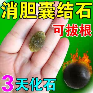 胆结石溶石化石治泥沙样胆囊多发息肉胆结石中草药结石排石胆康贴