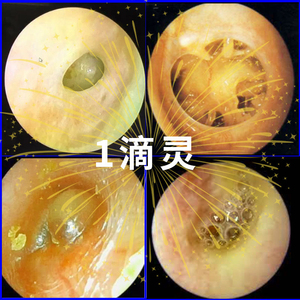 水杨酸滴耳液人用复方氯霉素地塞米松滴耳液耳朵流水流脓清洁止痒