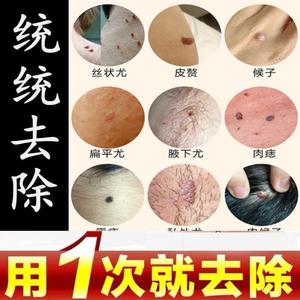 tb086276544淘宝去痦子黑痣膏猴子肉刺点掉凸起瘊子小肉粒丝状尤肉