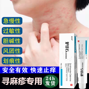治疗宝宝儿童寻荨麻疹过敏止痒断专用药膏根慢性止痒抑菌皮肤中药