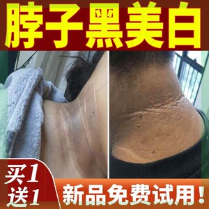 脖子黑洗不干净怎么办黑棘皮黑色素去除后颈部沉淀美白变白非神