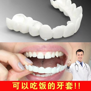 防塞牙牙齿贴片牙缝隙大树脂牙假牙全口假牙齿补牙洞贴片13人付款55