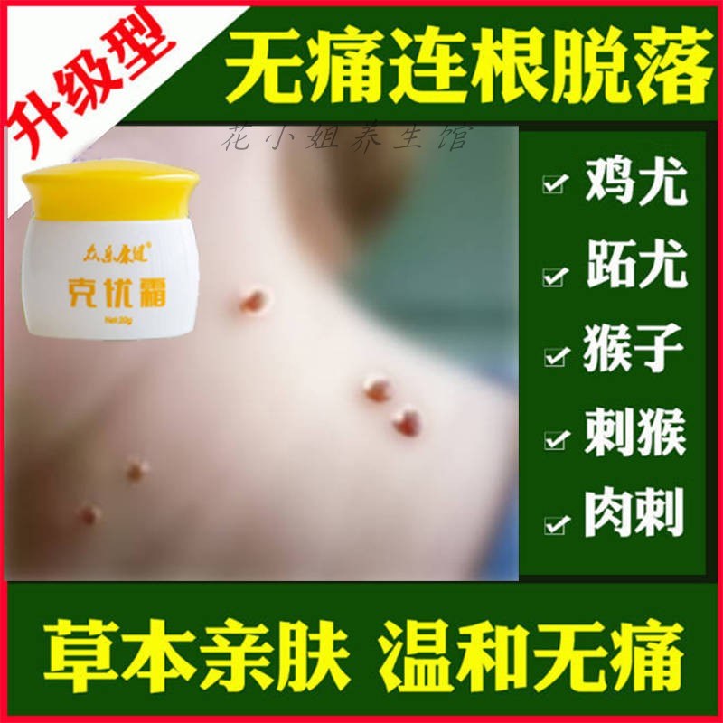 治祛去除脖子腋下小肉粒丝肉疙瘩i的药皮肤颈部皮赘肉瘤疣软膏液