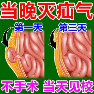 疝气贴治中老年婴儿腹股沟疝气腹股沟肚脐膏贴疝气贴内消丸膏药贴