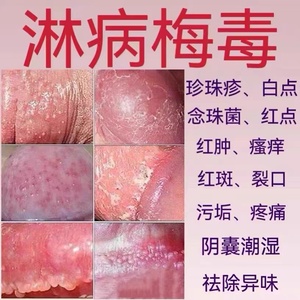 治龟头发药膏阴囊潮湿男科私处龟头红点包皮红肿瘙痒异味