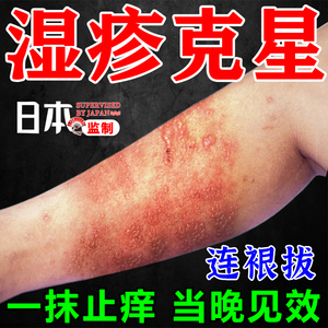 皮肤湿疹止痒去根顽固皮炎成人肛周阴囊私处大腿内侧瘙痒日本药膏