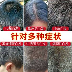 治疗白头发的洗发水