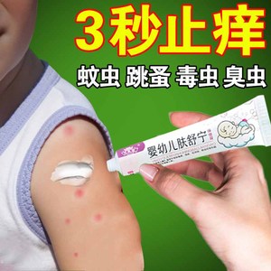 跳蚤咬蚊虫叮咬止痒消红肿药膏液臭虫蚊子咬儿童成人过敏皮肤外用