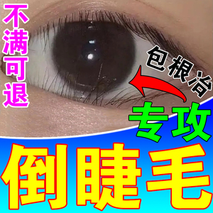 752人付款淘宝下睫毛倒睫毛神器 儿童 专用睫毛夹下睫毛夹倒睫专用