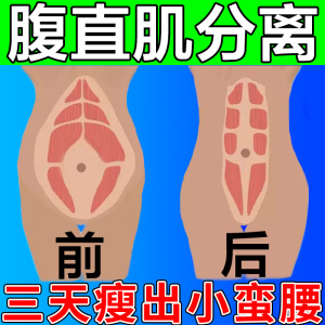 腹直肌分离修复贴片产后肚子大收腹调理盆底肌盆骨宽家用中药神器