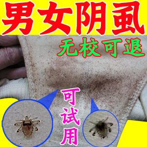 专治疗阴虱的药一扫光男女士用私处灭阴虱成人正品去除喷雾剂药物