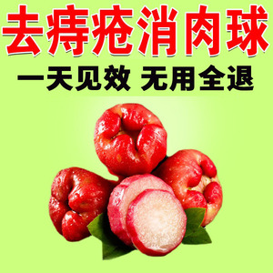 痔疮药膏外疮消肉球无花果叶子治疗痔疮的中药坐浴包必治断痔王茶