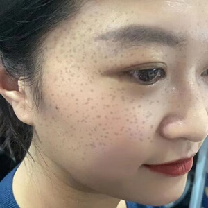 抖音同款 官方正品祛斑霜还你白净 去各种色斑 晒斑 雀斑 黄褐斑