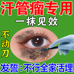 汗管瘤专用药膏眼部去除神器治眼周脂肪粒非针油脂粒扁平疣睑黄瘤