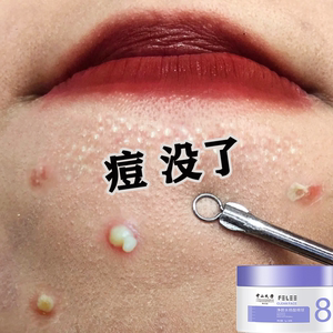 【小红书热推】净颜水杨酸棉片~不要脸上豆豆~和豆豆说拜拜买2送1