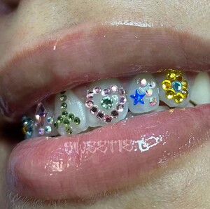 粘牙钻套装镶钻