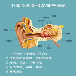 医院同款负压吹张器波氏吹张球扩成人儿童中耳鼓膜内陷咽鼓管堵塞