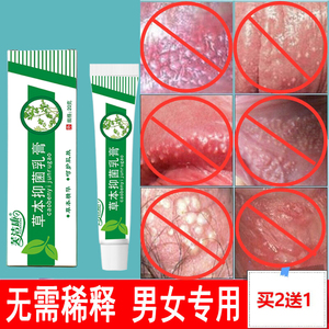 舒敏康脸上紫外线过敏皮肤修复换季脸部止痒膏晒伤面部脱皮红痒霜