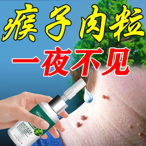 瘊子去除神器尤瘊脖子肉粒鸡眼丝状尤专用药手足肉刺鸦胆子祛尤膏