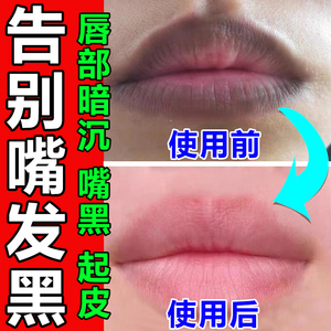 【嘴周暗沉】嘴周暗沉品牌,价格 - 阿里巴巴