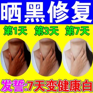 脖子黑黑的黑棘皮症去除黑色素沉淀治疗后颈美白晒黑洗不干净乳膏