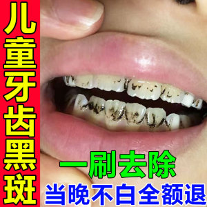 儿童去牙菌斑黑牙黑斑黑渍污垢清洁神器去除黄牙牙膏速效美白牙齿