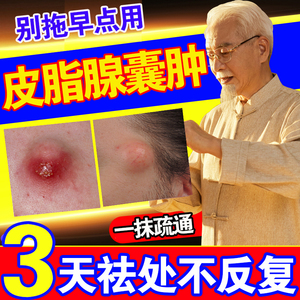 皮脂腺囊肿膏拔毒拔脓粉瘤疏通皮下脂肪瘤火疖子消脓包型痘痘粉刺