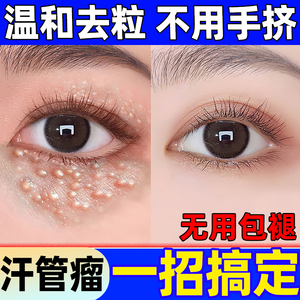 汗管瘤专用药膏眼部去除神器治疗眼周脂肪粒油脂粒扁平疣专用眼霜