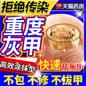 专治疗灰指甲专用药药膏药水正品旗舰店甲癣甲沟炎脚气非特效根BF