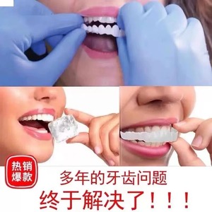 日本进口MUJIE牙套可吃饭神器临时美白缺门牙老人全口牙贴假牙套