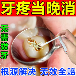 杀死牙神经去牙疼牙痛立可停专治儿童止痛药速效消炎牙龈肿痛牙膏