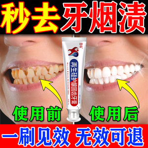 强力去烟渍牙膏去牙渍牙垢黄牙结石克星速效清除神器一擦即除牙膏