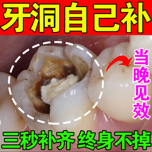 补牙神器自己在家补牙齿洞膏牙缝材料永久树脂假牙填补黑窟窿坏烂