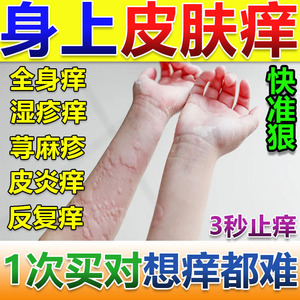 治疗皮肤痒专用药身上起红疙瘩老年人小孩儿童干燥瘙痒止痒抑菌膏
