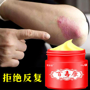 专治皮肤过敏止痒断根湿疹牛皮癣体藓水泡红疹瘙痒杀真菌外用药膏