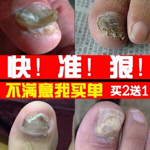 yupengting521淘宝美国康卫宁宠物猫狗长效消炎针犬猫绝育消炎慢性