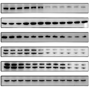 wb/条带/代做/结果/编辑/外包/实验/westernblot