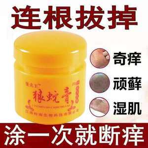 同款货源彡倾听淘宝治疗牛皮癣银屑皮肤瘙痒外用湿疹手足股藓根除