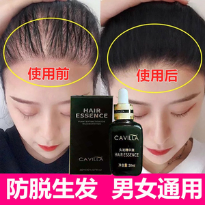 cavilla卡维拉育发液正品发际线增发密长增发头皮防脱发液男女士