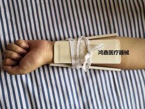 挠骨腕骨折用夹板可塑型高分子克雷氏固定夹板内置铝板