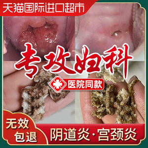 【直营】苦参妇科凝胶霉菌性炎阴豆腐渣阴道女私处护理液私密抑菌